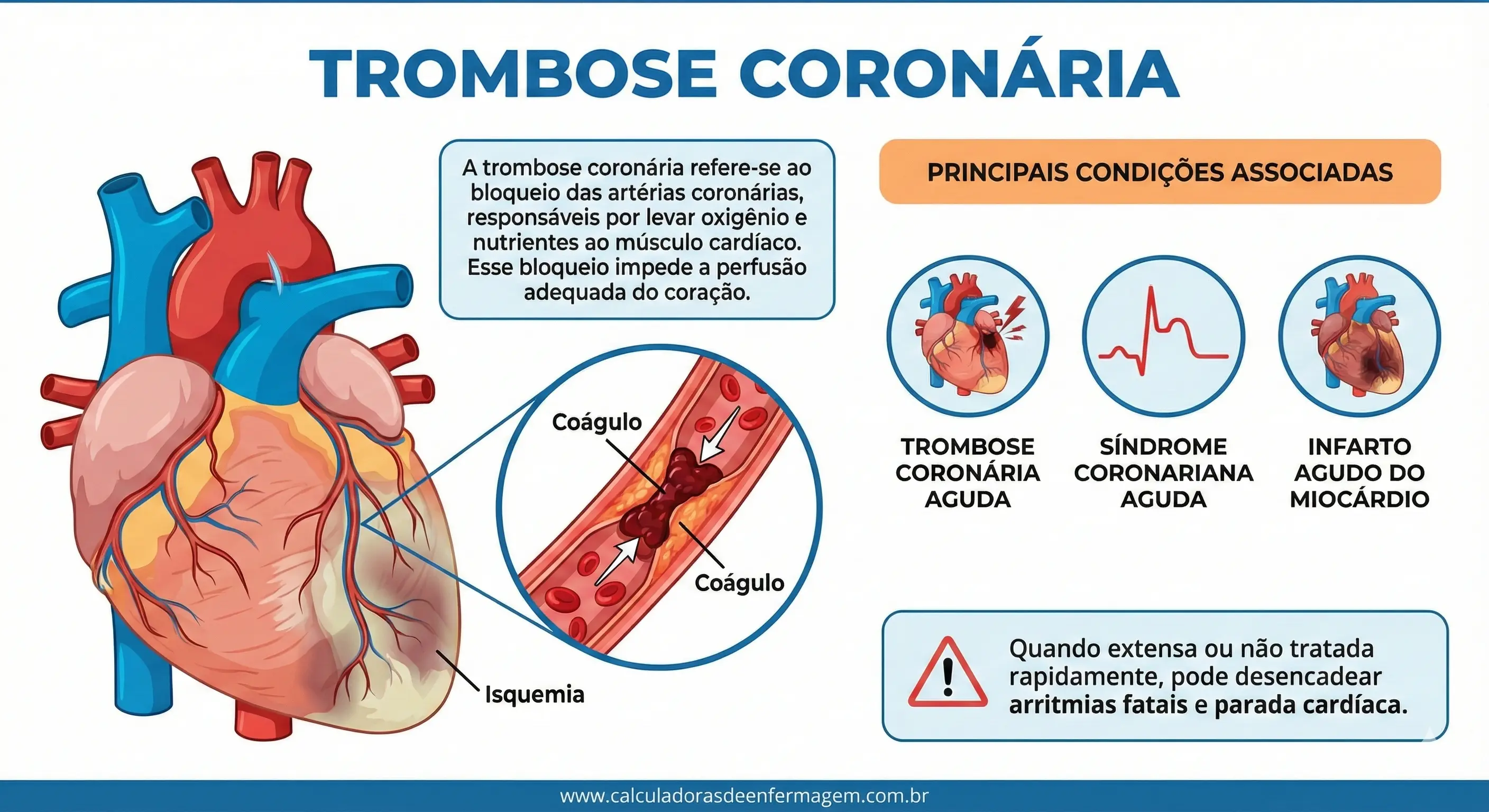 5ts Trombose Coronaria